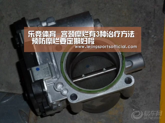 乐竞体育-宫颈糜烂有3种治疗方法 预防糜烂要定期妇检(图1) 乐竞体育官网入口
